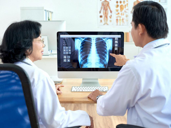 Chụp X-quang giúp phát hiện các khối u ở phổi