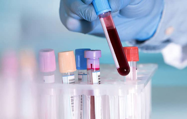Tầm soát ung thư bằng phương pháp xét nghiệm máu 