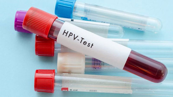 Tầm soát ung thư cổ tử cung bằng phương pháp xét nghiệm HPV test