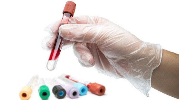 Tầm soát ung thư phổi bằng phương pháp xét nghiệm máu
