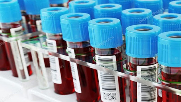 Tầm soát ung thư máu bằng phương pháp xét nghiệm tổng phân tích tế bào máu