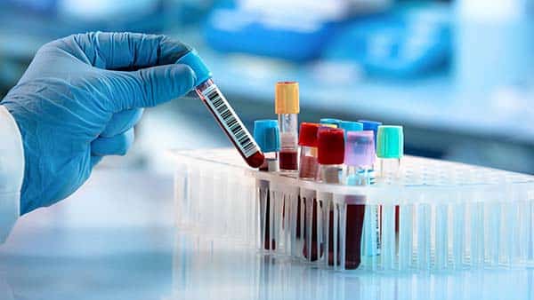 Xét nghiệm tổng phân tích tế bào máu