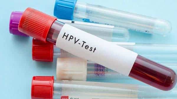 Phương pháp test HPV