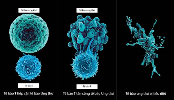 Hình ảnh kích thước tế bào ung thư 
