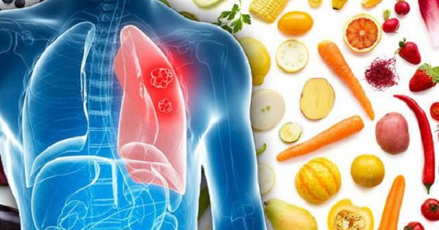Bệnh nhân ung thư phổi nên ăn gì?