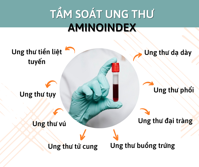 Với 5ml máu có thể phát hiện nguy cơ mắc một số loại ung thư phổ biến nhờ phương pháp xét nghiệm Aminoindex