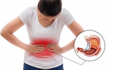 Đau bụng dữ dội vùng thượng vị có thể là dấu hiệu của bệnh ung thư dạ dày giai đoạn muộn