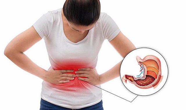 Đau bụng dữ dội vùng thượng vị có thể là dấu hiệu của bệnh ung thư dạ dày giai đoạn muộn