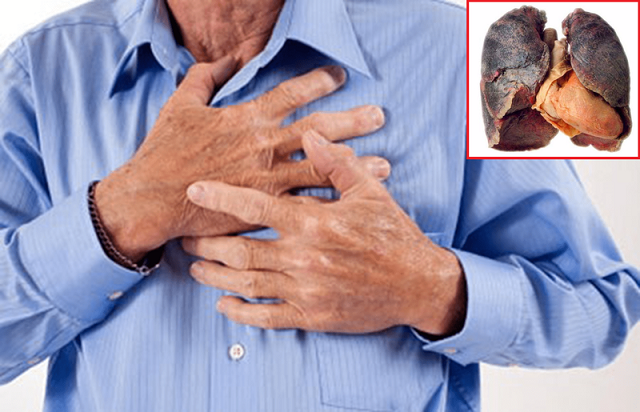 Đau tức vùng ngực dữ dội là một trong những biến chứng nguy hiểm của bệnh ung thư phổi