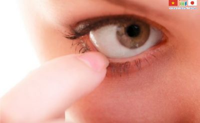 Ung thư mắt khiến người bệnh luôn cảm thấy khó chịu như có cộm trong mắt