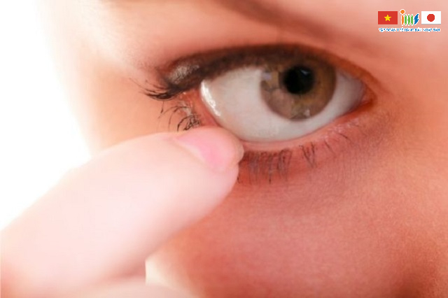 Ung thư mắt khiến người bệnh luôn cảm thấy khó chịu như có cộm trong mắt