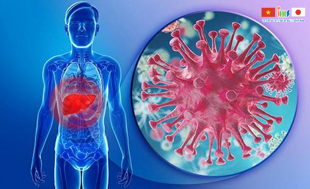 Virus viêm gan B được xem là nguyên nhân phổ biến nhất gây ung thư gan nếu không được điều trị kịp thời