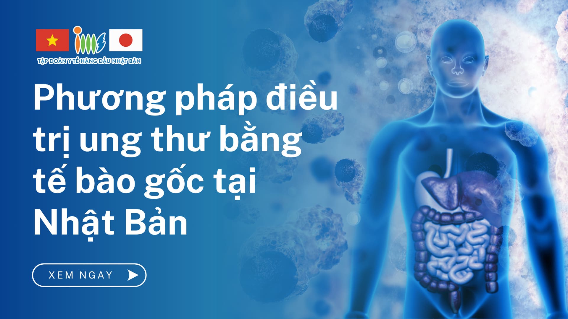 Tìm hiểu phương pháp điều trị ung thư bằng tế bào gốc tại Nhật