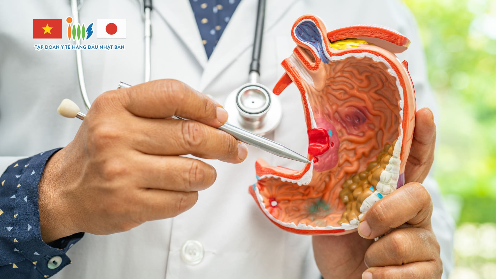 Các Phương Pháp Điều Trị Ung Thư Dạ Dày Tại Nhật