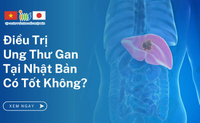 Điều Trị Ung Thư Gan Tại Nhật Bản Có Tốt Nhất Không?