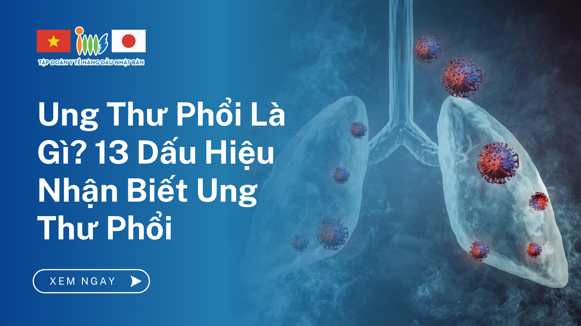 Ung Thư Phổi Là Gì? 13 Dấu Hiệu Ung Thư Phổi Dễ Nhật Biết