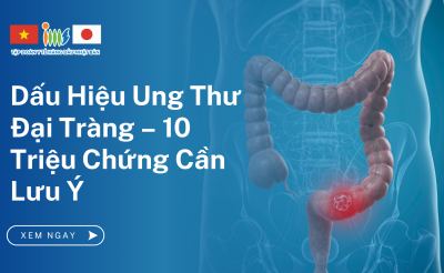 Dấu Hiệu Ung Thư Đại Tràng – 10 Triệu Chứng Cần Lưu Ý