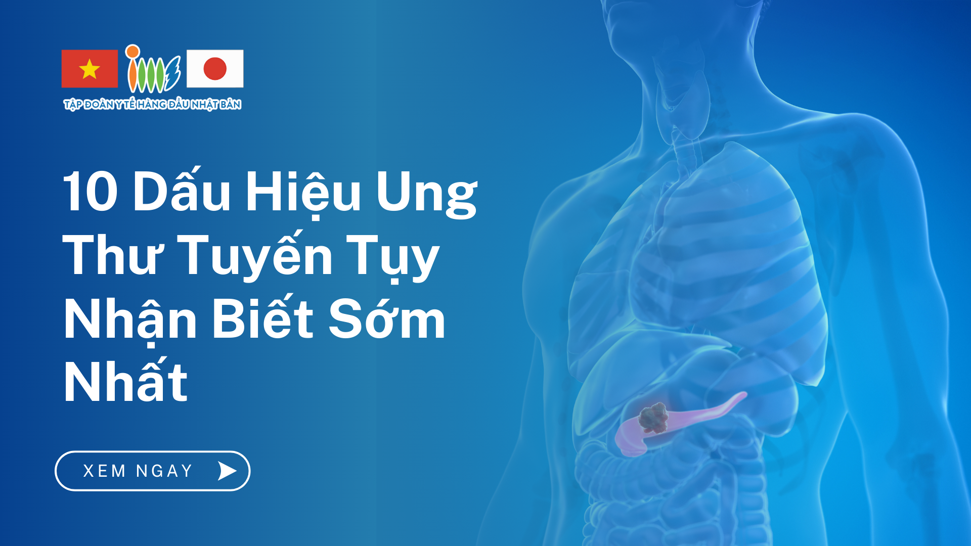 10 Dấu Hiệu Ung Thư Tuyến Tụy Nhận Biết Sớm Nhất